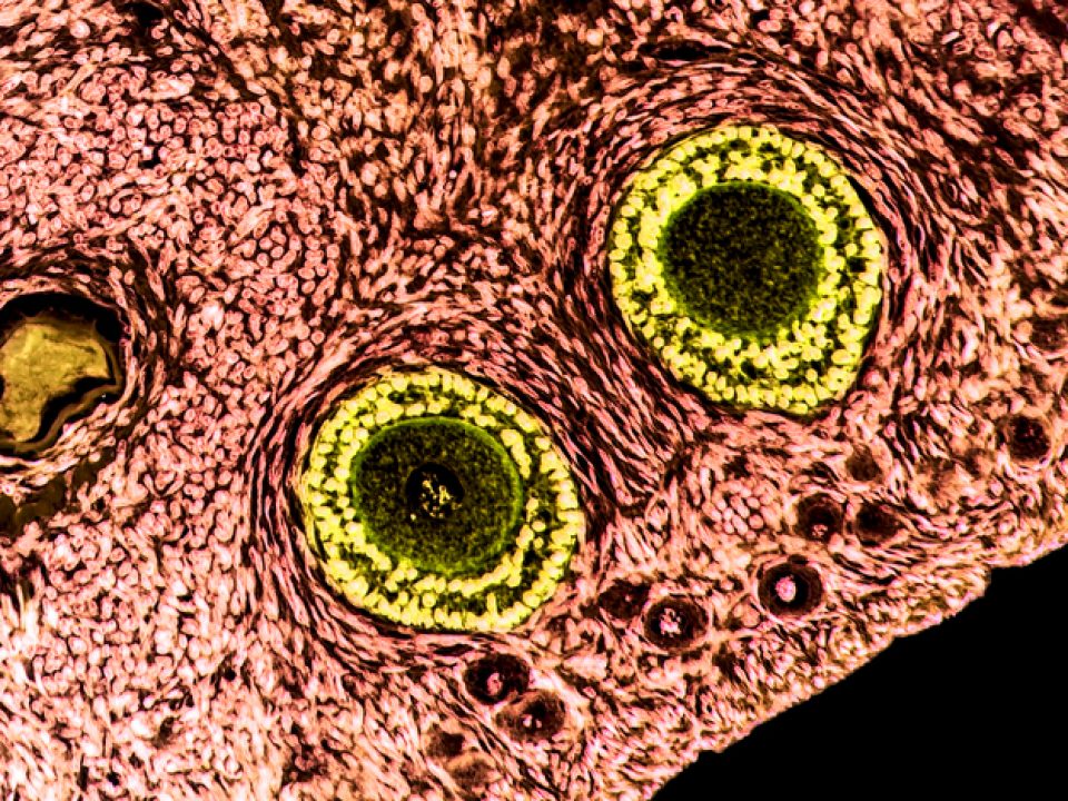 Ovarian follicles. Light microscopy