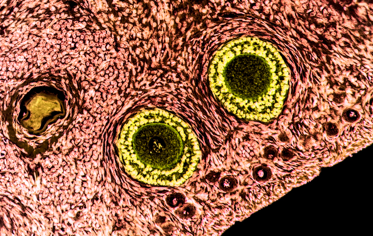 Ovarian follicles. Light microscopy